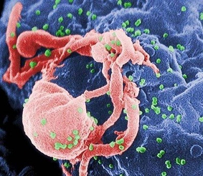 Những điều ít biết về HIV/AIDS 1