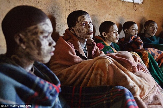 Chùm ảnh: Lễ cắt bao quy đầu đáng sợ ở Nam Phi