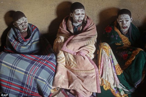Chùm ảnh: Lễ cắt bao quy đầu đáng sợ ở Nam Phi