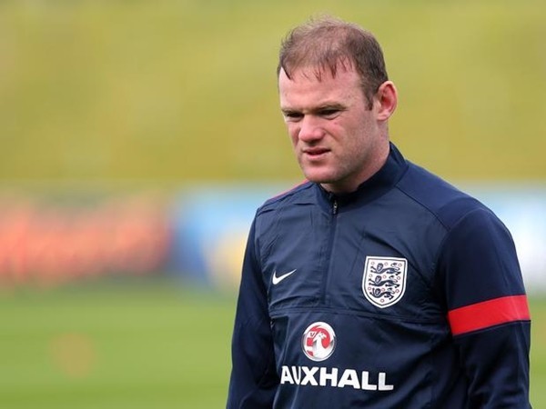 Tóc của Rooney: Vô phương cứu chữa 3