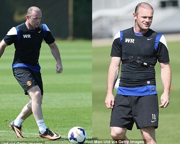 Tóc của Rooney: Vô phương cứu chữa 5