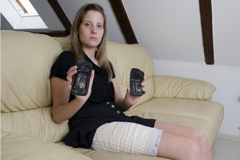 Thiếu nữ 18 tuổi bỏng nặng vì Galaxy S3