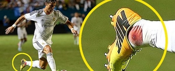 Điểm lại những lần đổ máu vì chấn thương của Ronaldo 1