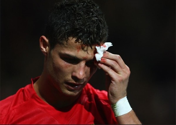 Điểm lại những lần đổ máu vì chấn thương của Ronaldo 11