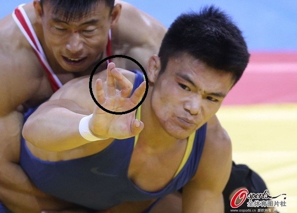 Gãy gập ngón tay, VĐV đấu vật Trung Quốc vẫn kiên cường thi đấu 1