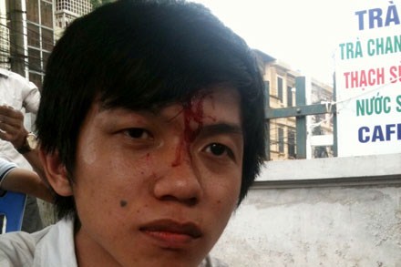  	Anh Nguyễn Hoàng Hưng – sinh viên Đại học Thủy lợi - bị nhân viên chi nhánh Định Công, Cty TNMU đánh chảy máu đầu.