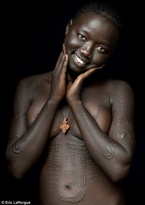 Vẻ đẹp: Hầu hết các phụ nữ tự hào mô hình xây dựng sẹo trên da của họ