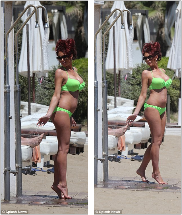 Người đẹp Amy Childs "đốt cháy" bãi biển Marbella