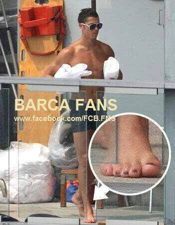 	Có phải là Ronaldo sơn móng chân không nhỉ?