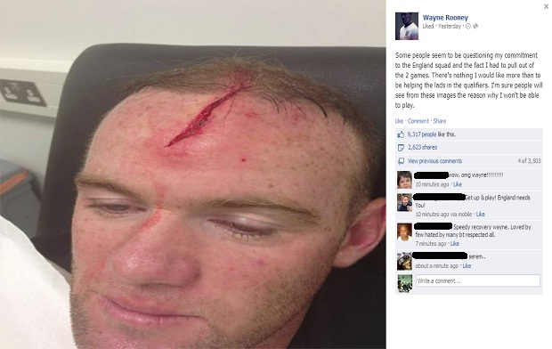 
	Rooney chia sẻ trên Facebook cá nhân và nhanh chóng nhận được sự ủng hộ của NHM