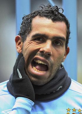  	Tevez bị đau răng?