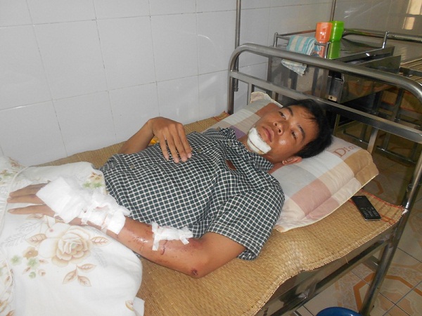 
	Đồng chí Long với nhiều vết thương đang được điều trị tại bệnh xã CA tỉnh Thanh Hóa