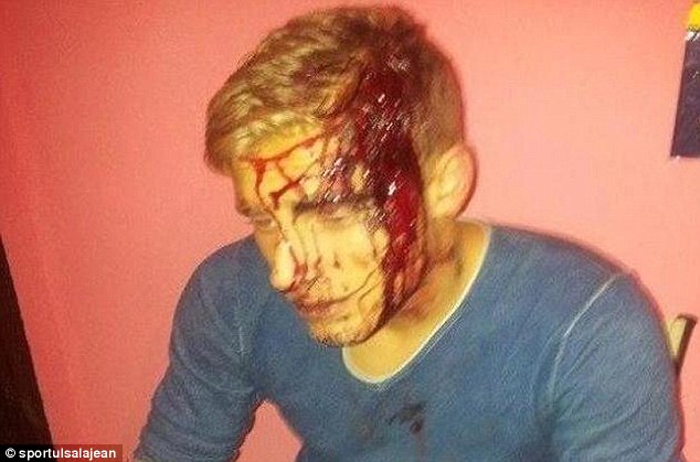 
	Đầu của Conner chảy be bét máu sau khi bị dân làng tấn công