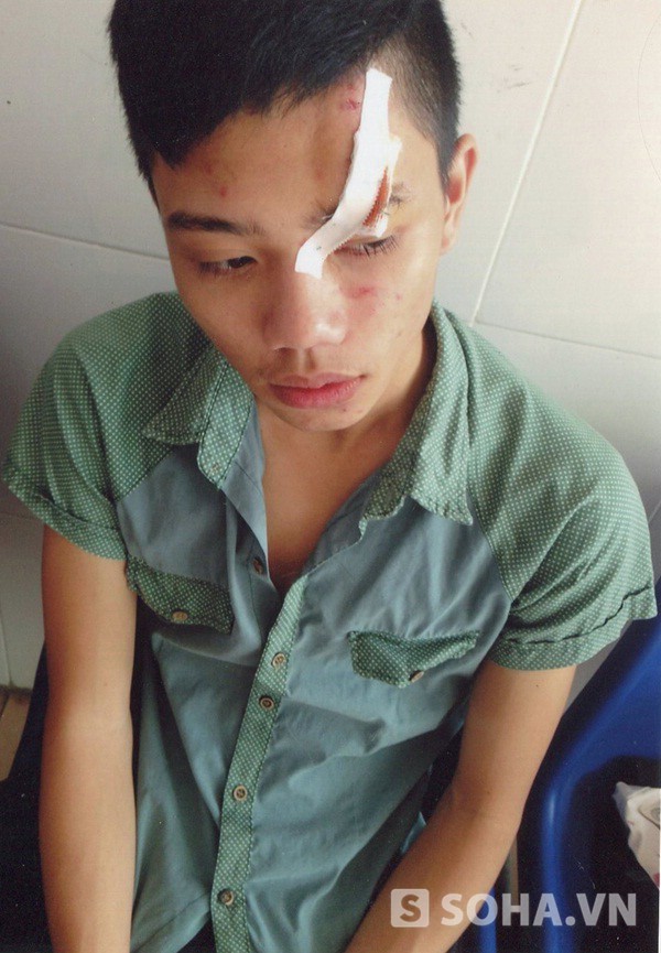 
	Anh Nguyễn Tất Tài bị chém đang điều trị tại bệnh viện