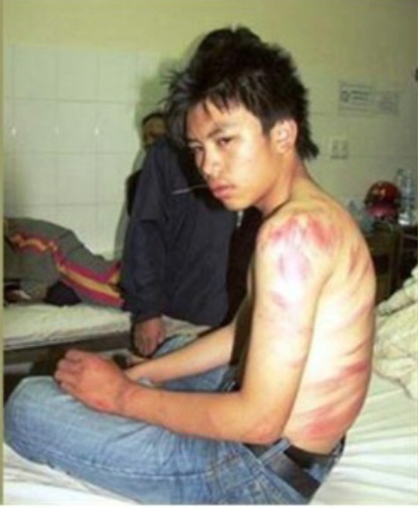 Học sinh Nguyễn Hoàng Long bị thầy giáo dùng roi mây đánh vào lưng vì đến lớp trễ.