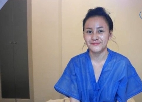 	Bà Tưng không ngần ngại chia sẻ những hình ảnh chưa được đẹp mắt sau khi vừa tháo chỉ phẫu thuật thẩm mỹ	 