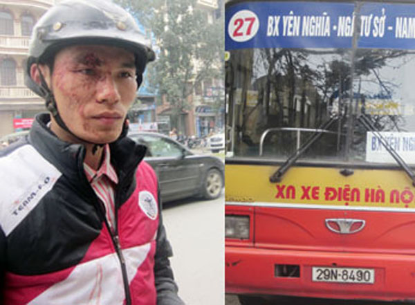 Lái, phụ xe của tuyến xe buýt mang BKS 29N - 8490 (chạy tuyến số 27: Bến xe Yên Nghĩa - Ngã Tư Sở - Nam Thăng Long) cùng xông vào đánh hội đồng khiến anh Chung chảy máu đầy mặt.