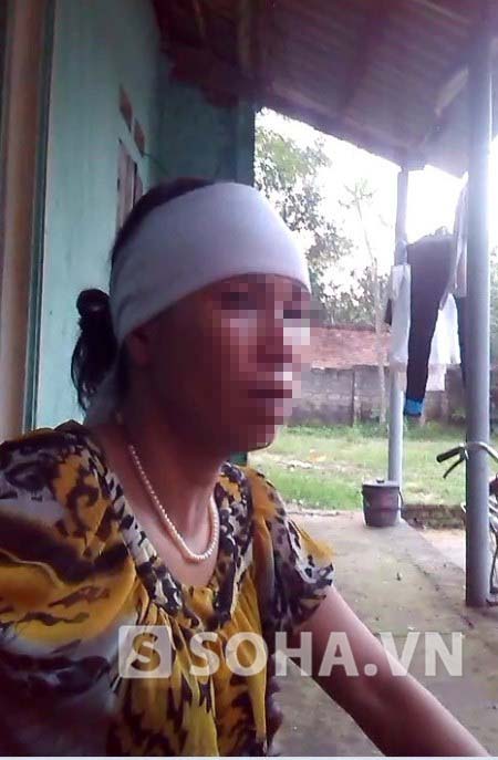 Chị N.T.H vợ đối tượng bị cả làng đánh chết do nghi trộm chó ở Bắc Giang, hiện tại chị đang rất bối rối sau cái chết của chồng.
