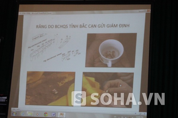 Hình ảnh về chiếc răng tìm được trong hài cốt của Liệt sĩ Phùng Chí Kiên do BCHQS tỉnh Bắc Cạn gửi giám định do Đại tá Hoà cung cấp.