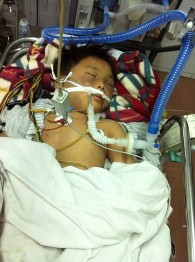Em Đỗ Doãn Lộc lúc hôn mê, được cấp cứu ở Bệnh viện Việt Đức.Ảnh: NGỌC DUNG