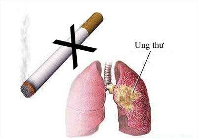 Các bệnh ung thư hay gặp do khói thuốc 1
