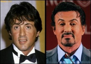 Sylvester Stallone before and after his plastic surgery fail - photo courtesy of funnie.st