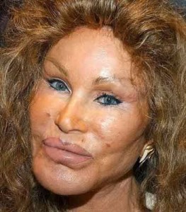 Plastic surgery fails, Jocelyn Wildenstein - photo courtesy of PhotoBucket