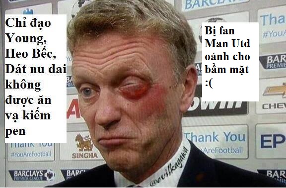 
	Đau lắm không David Moyes?