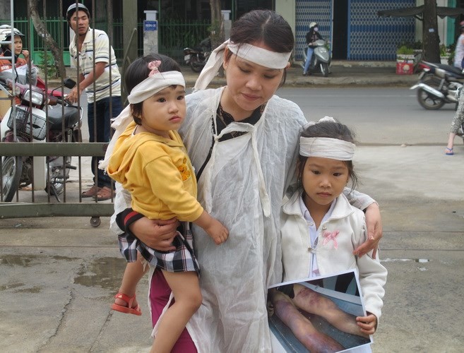  Bé Kim Oanh (2 tuổi) còn quá nhỏ, mẹ phải bế trên tay, gương mặt sợ hãi khi đến nơi xa lạ.