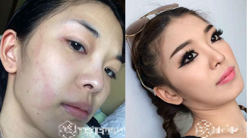  Khuôn mặt mộc của Yae Uunws lộ nhiều sẹo trắng ở mí mắt, trán và vệt  sẹo thâm dài ở má. Tuy nhiên, khi trang điểm thì không ai có thể nhận  ra các vết sẹo