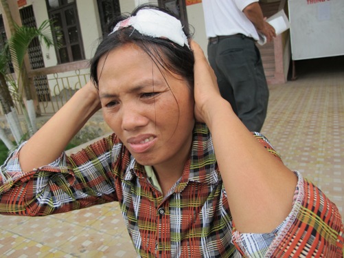 Bà Lương Thị Dĩnh, người dân bị côn đồ đánh bị thương trong vụ xô xát ngày 21-4