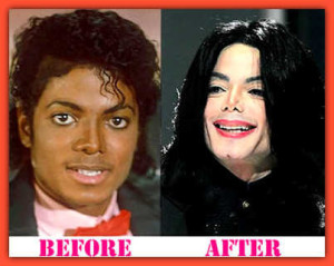 Plastic surgery fails, Michael Jackson - photo courtesy of celebplasticsurgery.com