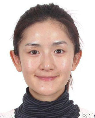 
	Tạ Na - MC nổi tiếng của Đài truyền hình Hồ Nam có chiếc cằm nhọn và hơi dài so với gương mặt. Đặc biệt khi cười, chiếc cằm tạo cảm giác gương
	mặt cô dài hơn và như bị móm.