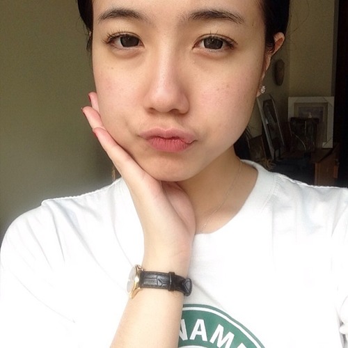 Da mặt của Mie Nguyễn xuất hiện nhiều đốm tàn nhang trên 2 má
