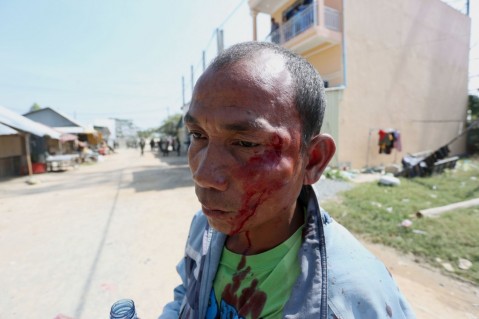  	Một người biểu tình bị thương trong vụ đụng độ. 