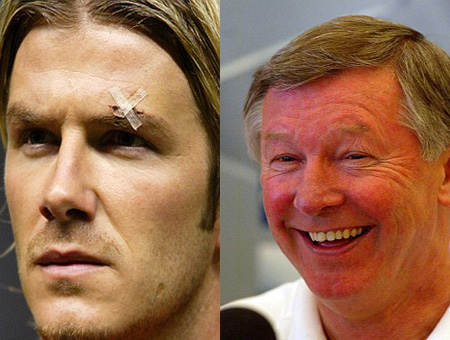  	Vụ Sir Alex đá giày vào mặt Beckham