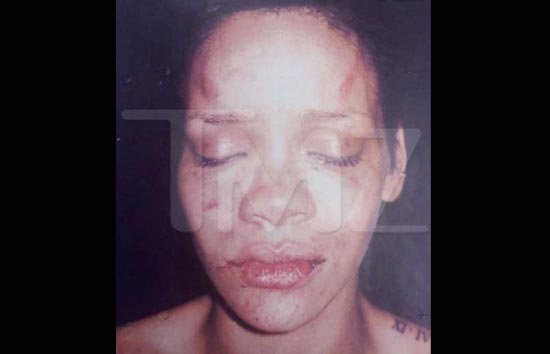 Chris Brown lại bị kiện vì tội hành hung - Ảnh 1.