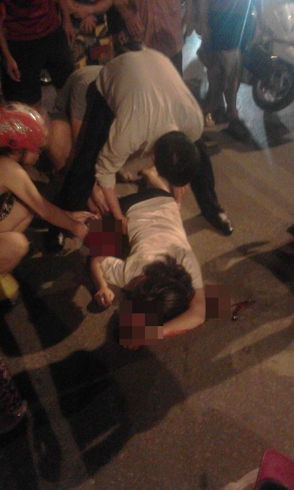 Cô gái trẻ đi Vespa bị giật túi xách ngã ra đường, bất tỉnh - Ảnh 1.