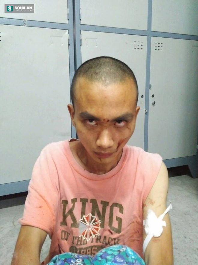 Truy sát trong chùa ở Sài Gòn: Bắt hung thủ 21 tuổi - Ảnh 1.