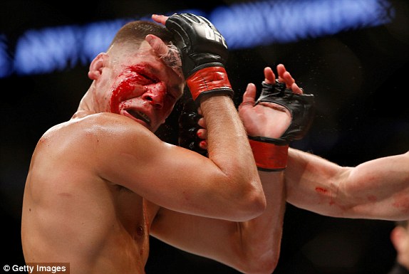 “Gã điên” McGregor thắng nghẹt thở sau trận đấu đẫm máu - Ảnh 2.