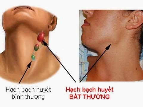 Những dấu hiệu không đau thường dễ bị bỏ qua của ung thư - Ảnh 3.