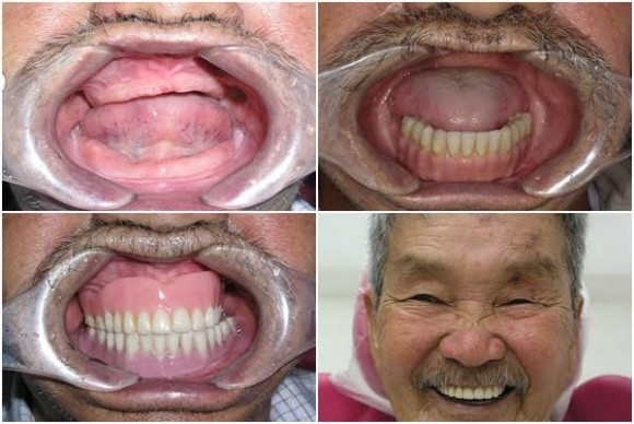 Chương trình từ thiện Nụ cười hạnh phúc mang tới 30 cơ hội làm răng miễn phí - Ảnh 1.