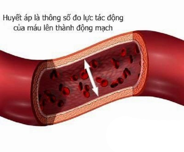 48% dân số Việt Nam mắc bệnh cao huyết áp - Ảnh 1.