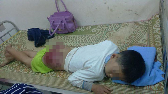 Phẫn nộ hình ảnh con 13 tuổi ở Thái Nguyên bị bố đánh tứa máu - Ảnh 1.