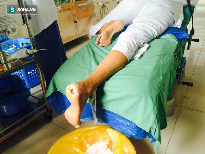 Căn bệnh nguy hiểm 20 giây lại có 1 người bị cắt chân: Ngày càng có nhiều người Việt mắc - Ảnh 2.