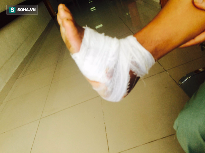 Căn bệnh nguy hiểm 20 giây lại có 1 người bị cắt chân: Ngày càng có nhiều người Việt mắc - Ảnh 3.