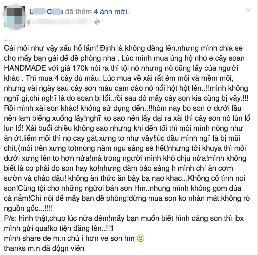 Đôi môi khốn khổ của cô nàng dùng phải son rởm - Ảnh 1.