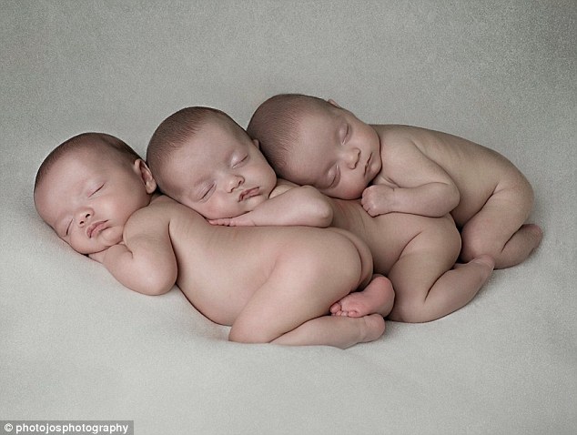 Trường hợp cực hiếm: Anh em sinh ba giống nhau tuyệt đối - Ảnh 1.