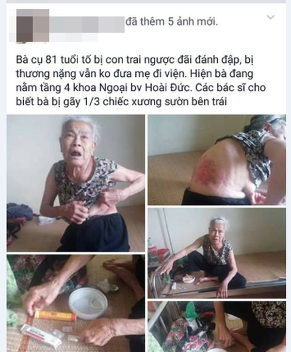 Hà Nội: Mẹ già 81 tuổi tố bị con trai út đánh gãy xương sườn, đuổi khỏi nhà - Ảnh 1.