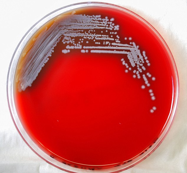 Khám phá bí ẩn về siêu vi khuẩn ở Việt Nam, có thể giết chết bạn trong vòng 2 ngày - Ảnh 1.